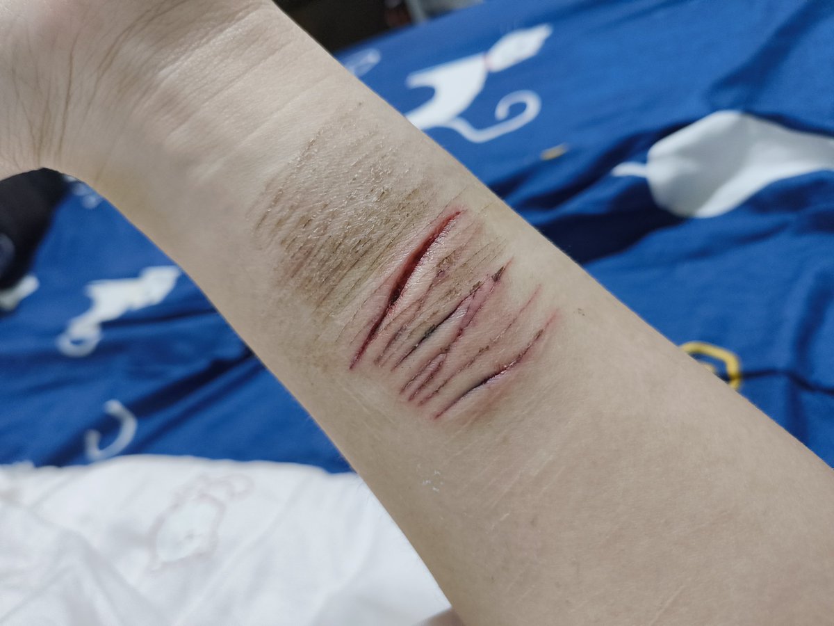 yujing375661's tweet image. #shtwt #selfharm