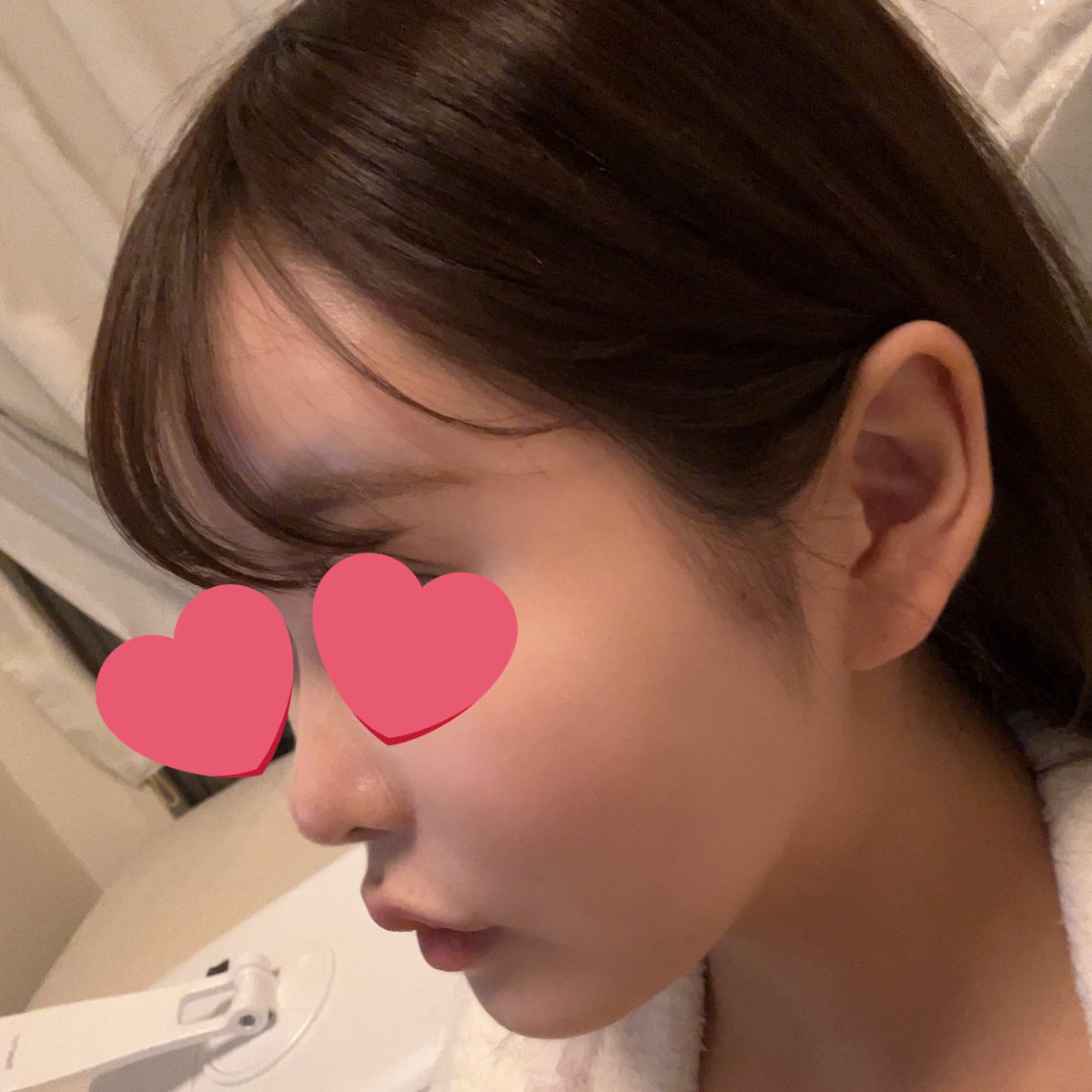 来世はいぬ💖脂肪移植DT tweet media