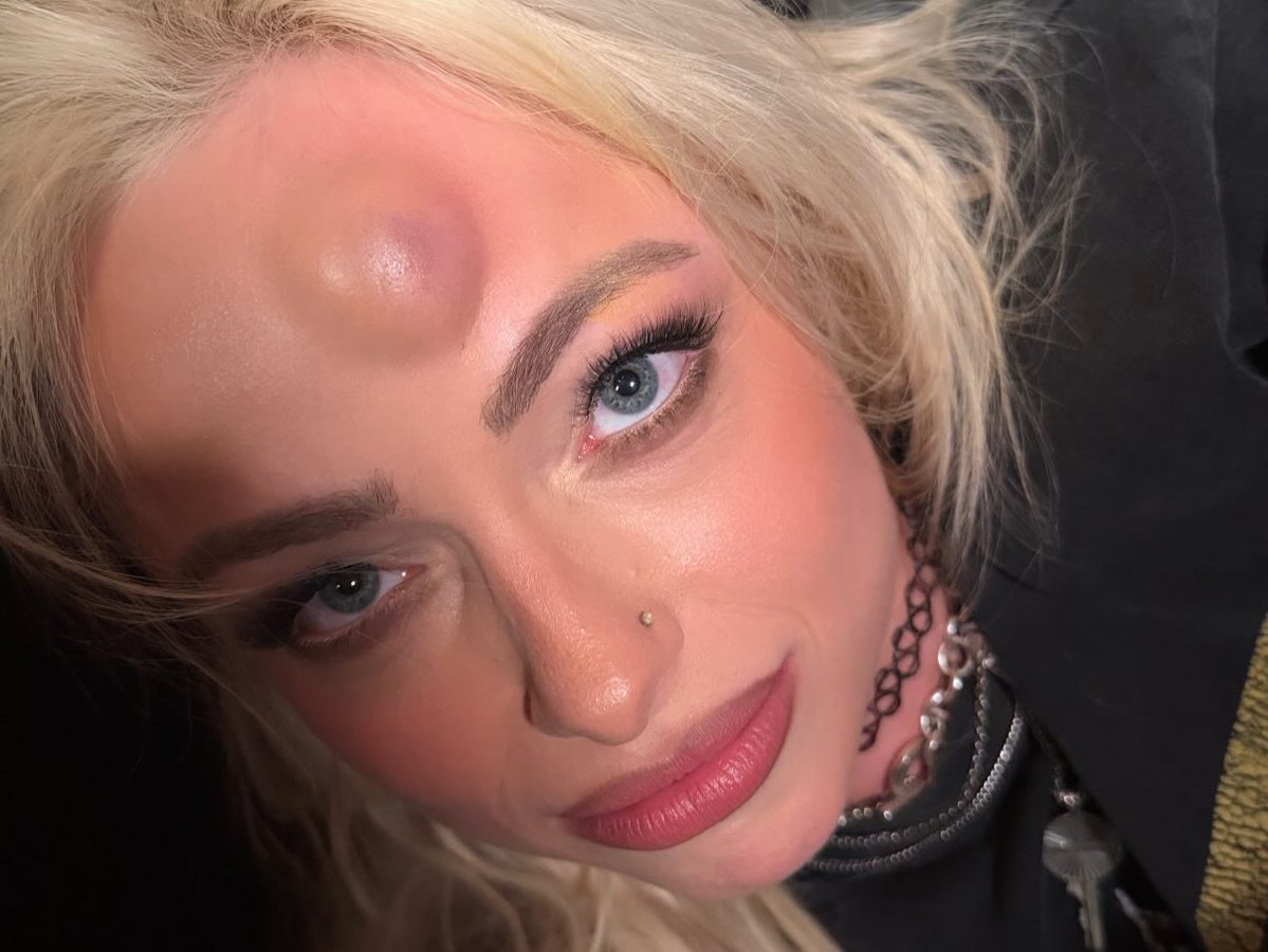 Catch-Newz tweet media