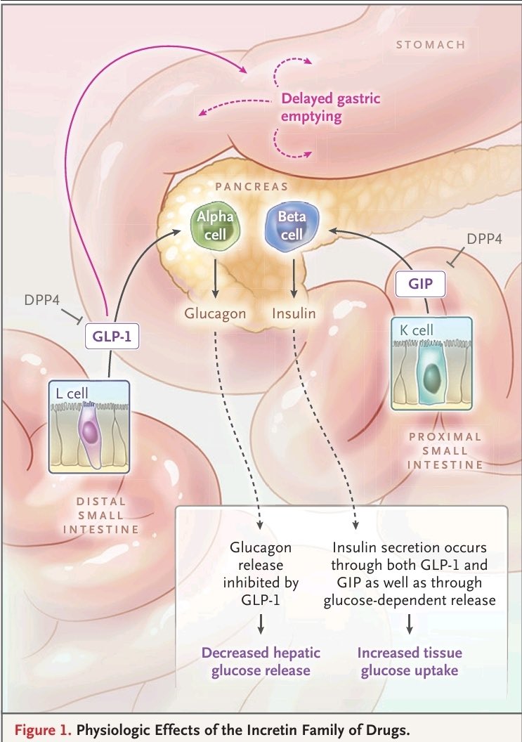 drsecchi's tweet photo. Agonistas del receptor de GLP-1: lo que debes saber de los nuevos tratamientos para diabetes tipo 2 y obesidad. https://t.co/Wd4OeZXvqf