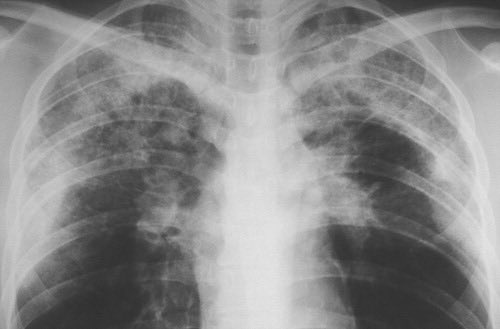 ريان | MD1TALK🌟 tweet media