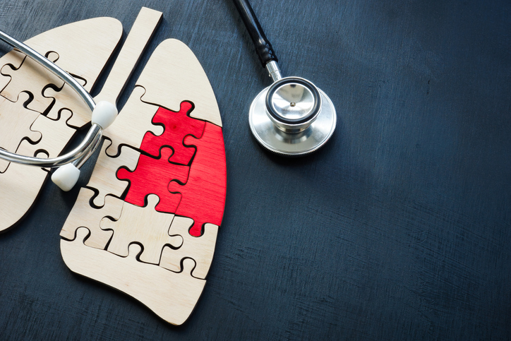 ASCOPost's tweet image. 1️⃣ -time low-dose CT screening for #lungcancer in a non–risk-based population can improve lung cancer mortality rates, study shows.
Findings challenge current guidelines to risk-based screening.
🫁 Presented at #ELCC26; comments from @marinagarassino
ascopost.com/news/april-202…