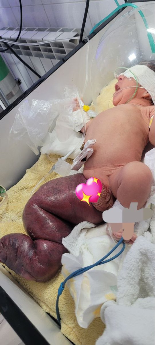 Dr.Haitham Hamoud | د.هيثم tweet media