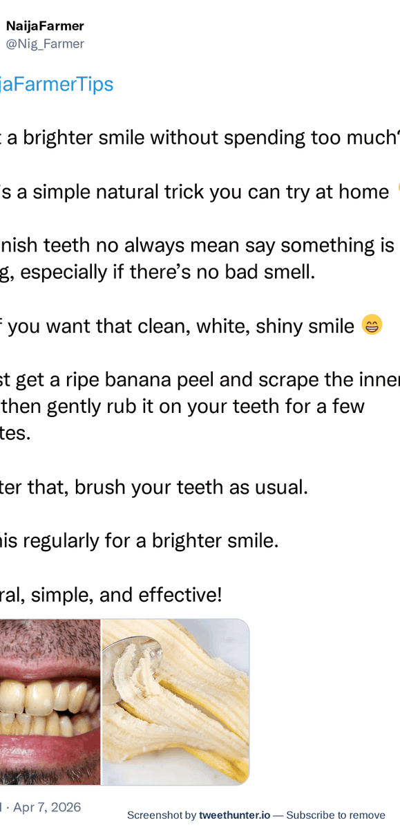 tweethunter tweet media