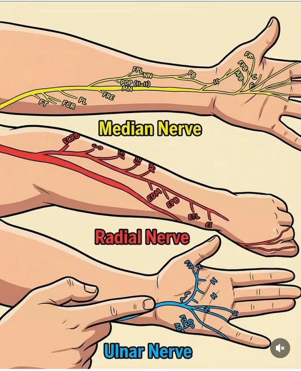 physio_clinics's tweet photo. 📚 تتلخص الأعصاب الرئيسية الثلاثة في الذراع واليد فيما يلي:

1. العصب المتوسط (Median Nerve)
•المسار: يمر أسفل الجزء الداخلي للذراع ويعبر من مقدمة المرفق وصولاً إلى الرسغ عبر "النفق الرسغي".
•الوظيفة الحركية: يتحكم في العضلات التي تساعد على ثني الرسغ والأصابع.
•الوظيفة الحسية: يوفر الإحساس في الإبهام، السبابة، الإصبع الأوسط، ونصف إصبع البنصر. ￼
•NewYork-Presbyterian 
2. العصب الكعبري (Radial Nerve)
•المسار: يمتد على طول الجزء الخلفي من عظمة العضد وصولاً إلى اليد.
•الوظيفة الحركية: يتحكم في العضلات الباسطة (التي تساعد على فرد المرفق والرسغ والأصابع).
•الإصابة الشائعة: قد يؤدي تلفه إلى حالة تُعرف بـ "سقوط الرسغ" (Wrist Drop). ￼

3. العصب الزندي (Ulnar Nerve)
•المسار: يمر خلف المرفق (فيما يعرف بالعظمة المضحكة) ويمتد على طول جانب الساعد حتى اليد.
•الوظيفة: يتحكم في معظم العضلات الصغيرة في اليد التي تسمح بالحركات الدقيقة، ويوفر الإحساس في إصبع الخنصر ونصف إصبع البنصر.
•الإصابة الشائعة: قد يؤدي تلفه إلى حالة تُعرف بـ "اليد المخلبية" (Claw Hand).
