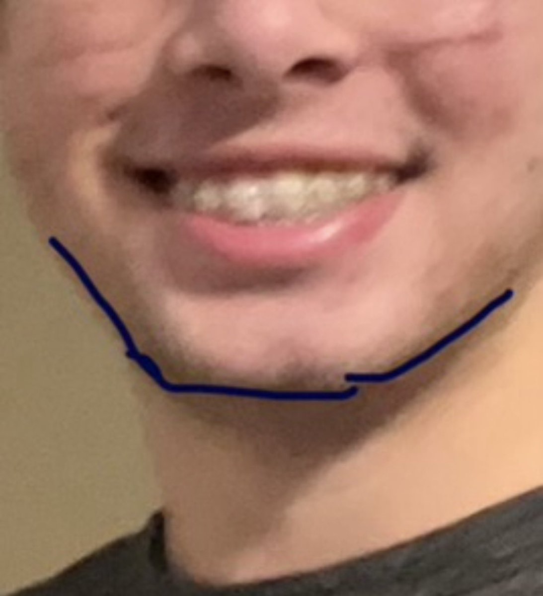 Aspen goes birding⛸️ tweet media