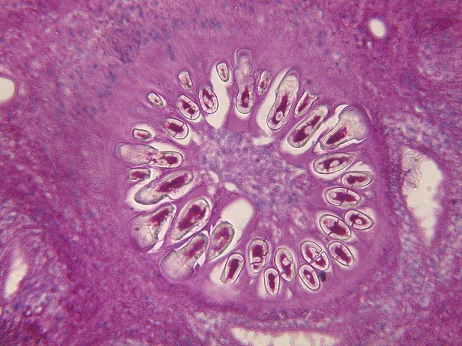 alaboudkhalid's tweet photo. ⁦⁦@RitchaSaxena⁩ @feldstej ⁦@guerreroespejo @ilovepathology ⁦⁦@ParasiteGal⁩ @iheartpath @mvmd0908 identify this parasitic structure &amp; win.Check your answer &amp; Prize with @DrGeeONE 
Refractile hooklets in #Cysticercosis (caused by pork tapeworm) #Parasitology https://t.co/RzGax14gdh