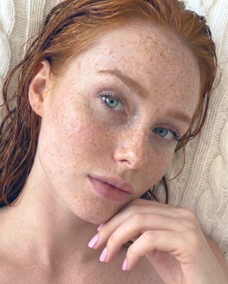 FreckledFace111's tweet image. #FreckledFace 🩵#Beauty