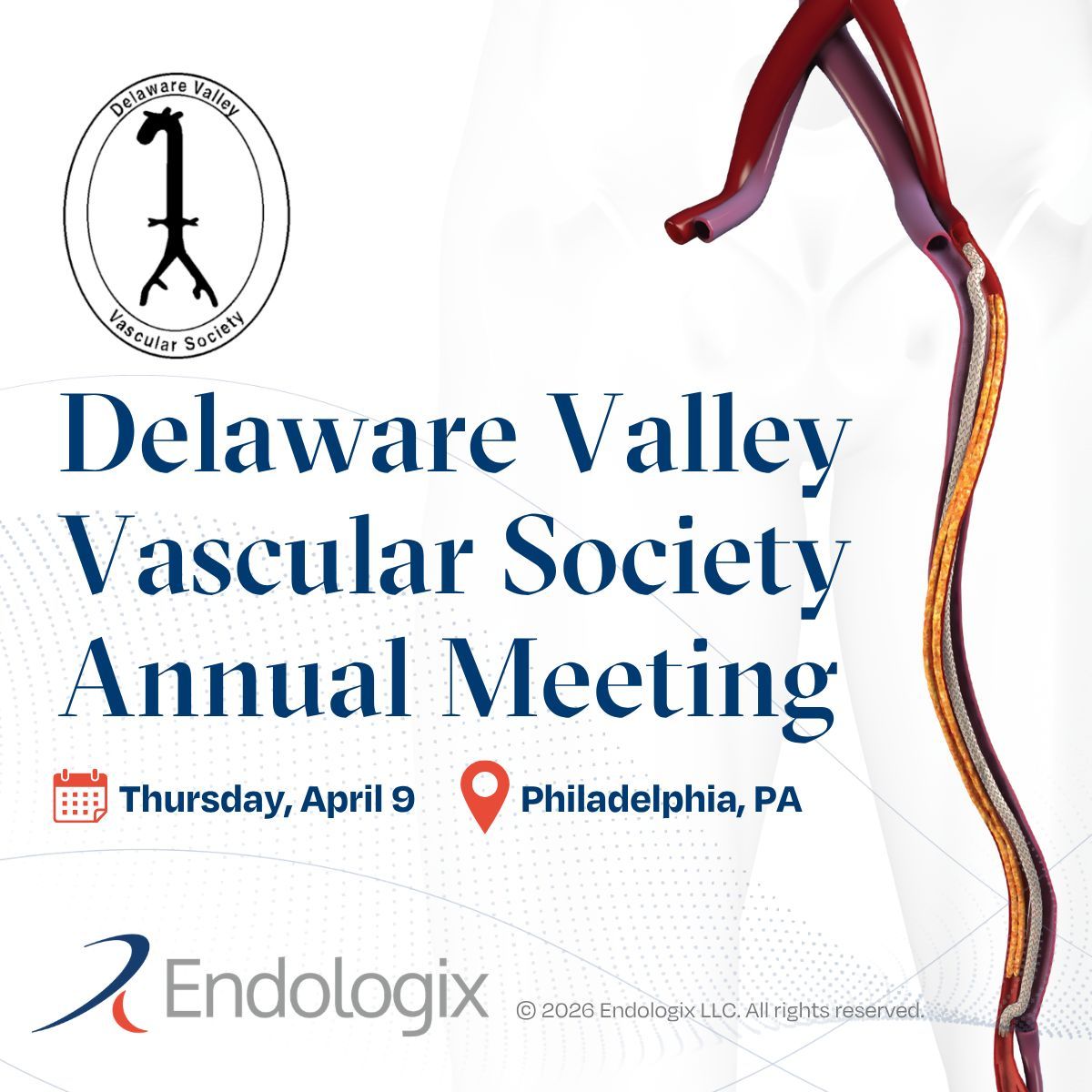 endologix's tweet photo. Next stop: Philadelphia. 
Visit our booth at the Delaware Valley Vascular Society Annual Meeting to see the latest evidence supporting #PTAB with the #DETOURSystem as a safe and durable endovascular intervention for patients with long complex #SFA disease.

Learn about the DETOUR System here: https://t.co/ycFuGmcK9i

@VascularSVS #PeripheralArteryDisease #medtech #healthcareinnovation #medtwitter #cardiotwitter #endovascularinnovation #medicalinnovation #percutaneous