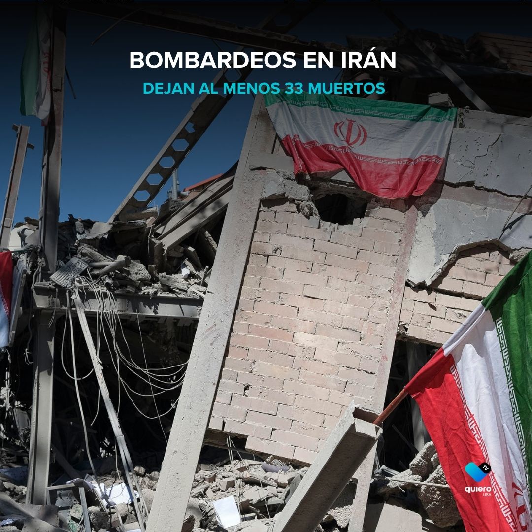 quierotvusa's tweet image. 💔🔥 Bombardeos dejaron al menos 33 muertos, incluidos niños 💥 La tensión sigue escalando mientras civiles quedan en medio del conflicto ⚠️

👇Esto es lo que sabemos👇
quierotvusa.com/bombardeos-en-…

📷 EFE
#Irán #Guerra #Bombardeos #OrienteMedio #Crisis #EstadosUnidos
