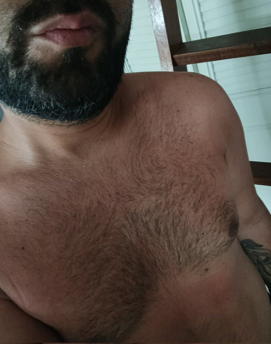 Emilixon's tweet photo. Adivinen quién se bronceo como si no hubiera un mañana en #Medellin y ahora está pagando las consecuencias con una piquiña #hdp 😏 https://t.co/Yh8n0wjP5e