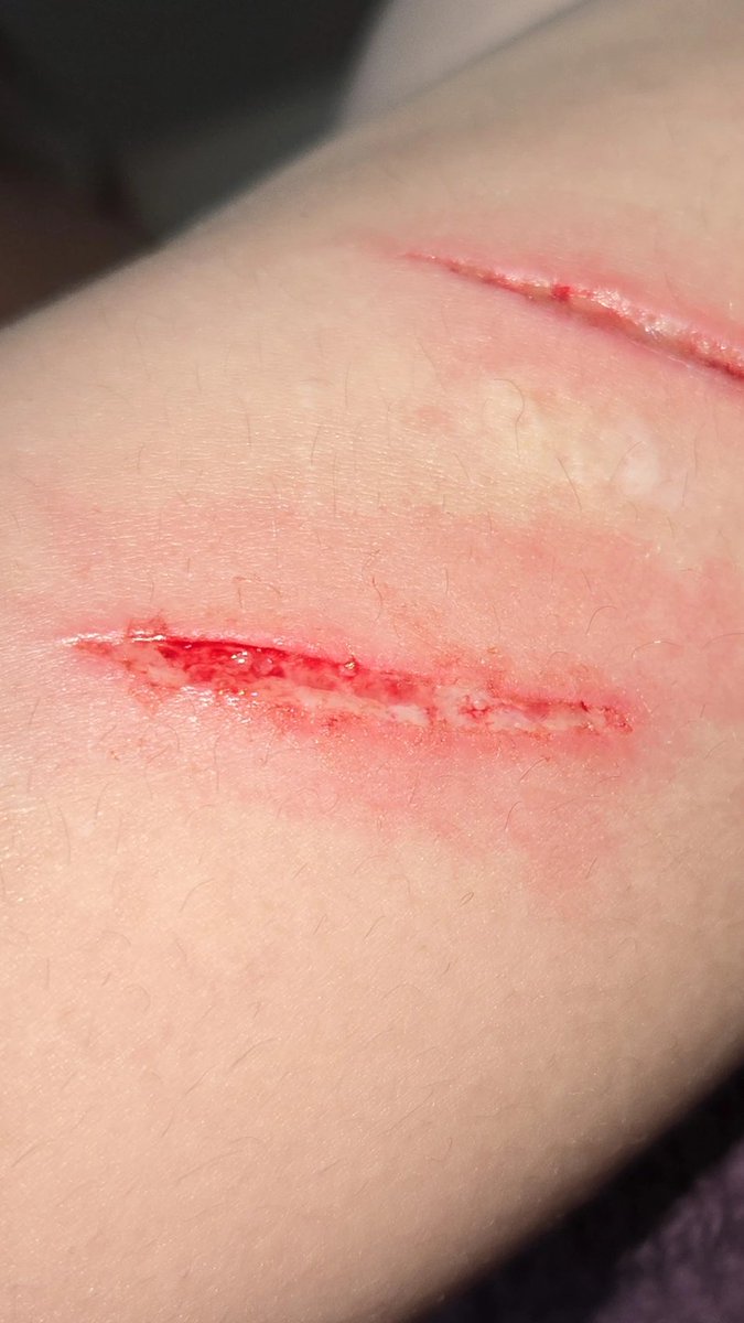 alice :3 tweet media