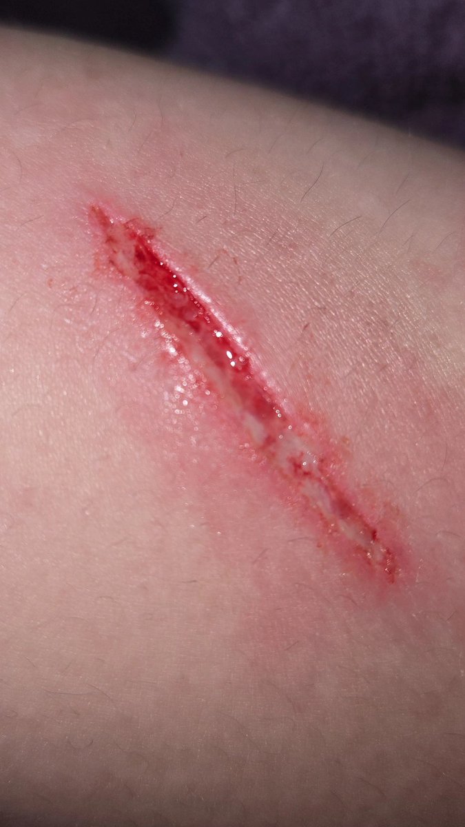 alice :3 tweet media