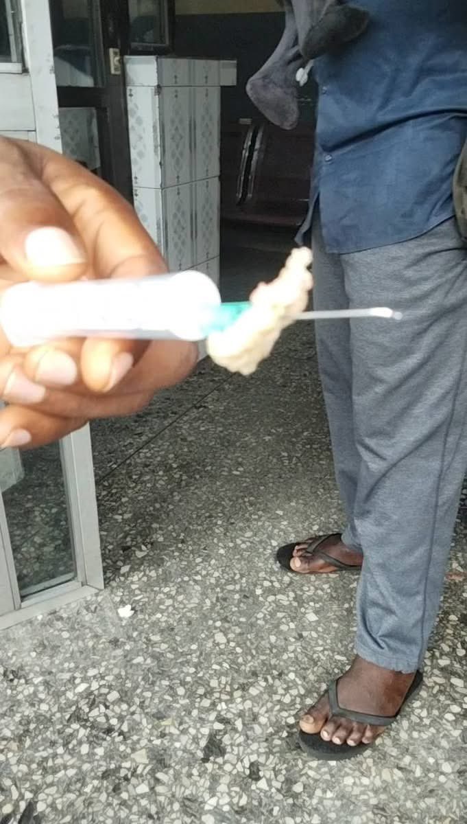 Medzonetv's tweet image. A 24-year-old House Officer is performing an emergency paracentesis on a patient with advanced liver cirrhosis. 🏥

The patient is restless, the ward is dimly lit, and the tension is high.

As the HO withdraws the 18G needle, the patient suddenly jerks.

The needle pierces the