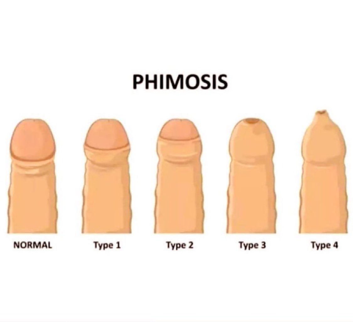 Dr Honey choudhary 🩺 tweet media