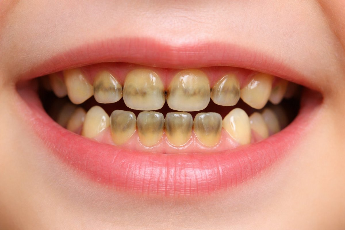 Abdulhamid tweet media