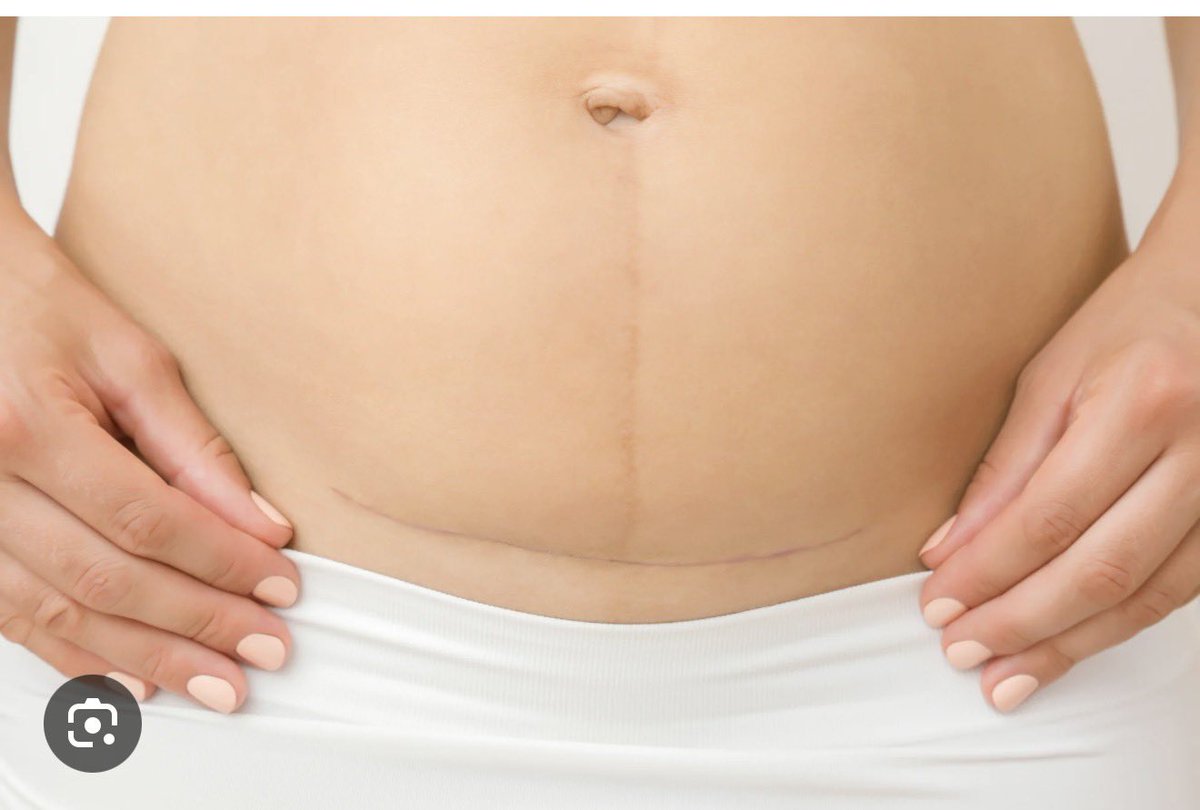 Dr PT 👩🏻‍⚕️ tweet media