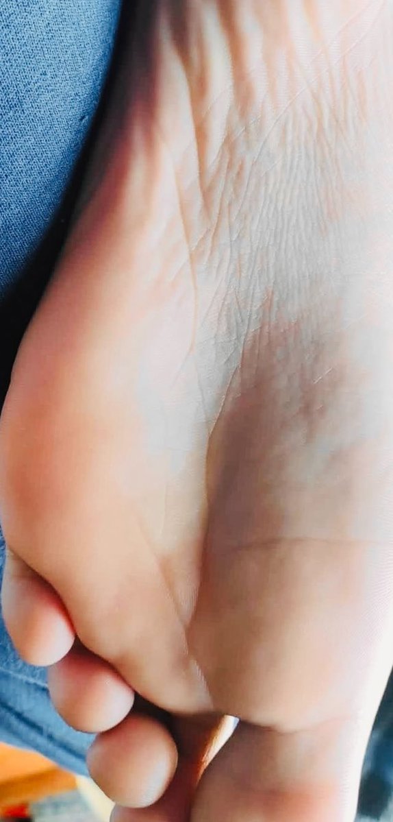 ⚡️Capy Sly Fox➡️FCL⚡️ tweet media