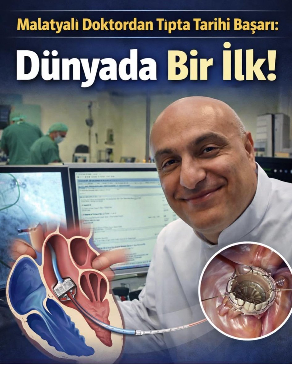 TOPRAK_2_'s tweet photo. Almanya’da görev yapan Türk bilim insanı Prof. Dr. Hüseyin İnce, kalp kapakçığı tedavisinde dünya tıp literatürüne geçecek bir başarıya imza attı.
İnce ve ekibi, ileri derecede triküspit kapak yetmezliği bulunan bir hastada, yeni nesil kapak protezini minimal invaziv yöntemle başarıyla yerleştirdi.
📌 Bu yöntemle:
▪️ Göğüs kafesi açılmadan
▪️ Kasık damarından girilerek
▪️ Kalbe ulaşılıp kapak yerleştiriliyor
Üstelik yeni teknoloji sayesinde kapak:
✔️ Yeniden konumlandırılabiliyor
✔️ Gerekirse tamamen çıkarılabiliyor
Daha önce yüksek risk nedeniyle ameliyat edilemeyen birçok hasta için bu yöntem yeni bir umut olarak görülüyor.
📊 Şu ana kadar dünyada yaklaşık 80 hasta bu yöntemle tedavi edildi. Almanya’daki ilk hastalar ise İnce’nin görev yaptığı merkezlerde başarıyla iyileşti.
💬 Prof. Dr. İnce’den önemli uyarı:
“Nefes darlığını hafife almayın. Bu durum sadece kilo ile ilgili olmayabilir, mutlaka bir doktora başvurun.”
Göçmen bir ailenin çocuğu olarak Almanya’da yetişen İnce’nin bu başarısı, Türk bilim insanlarının dünya çapındaki etkisini bir kez daha gözler önüne serdi.