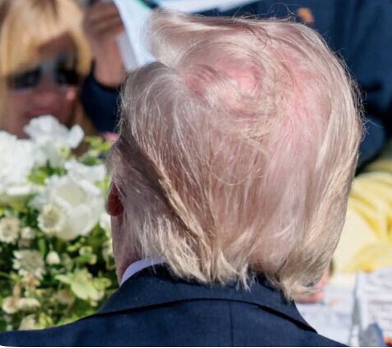 temotizox's tweet photo. Estoy bastante seguro de que Trump realmente no quiere que esta foto de su calva circule... así que, hagas lo que hagas, ¡NO la retuitees! https://t.co/1ntw7w0YYh
