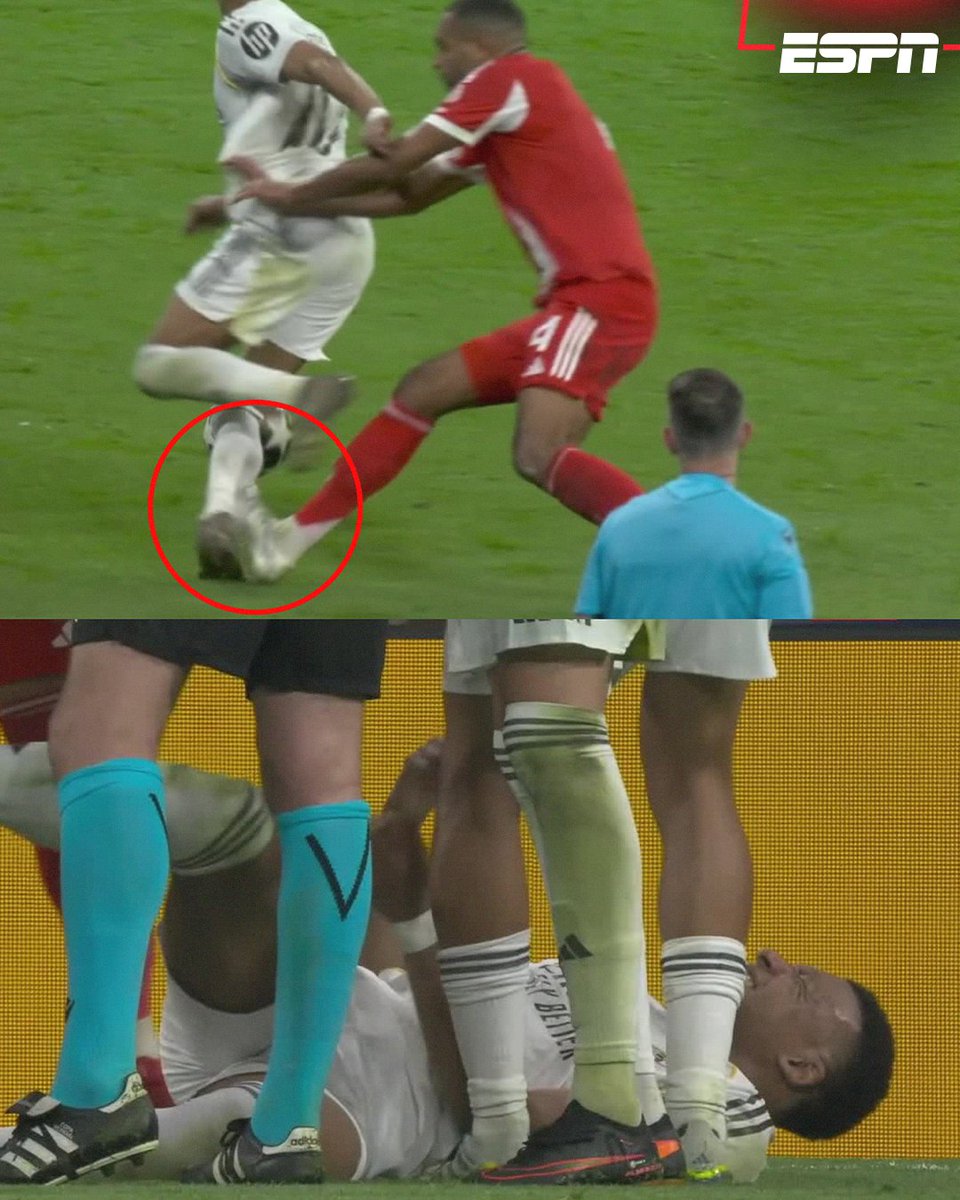 ESPNmx's tweet image. ¿¿ERA ROJA?? 

La entrada de Jonathan Tah sobre Mbappé se quedó solo en amarilla 😳