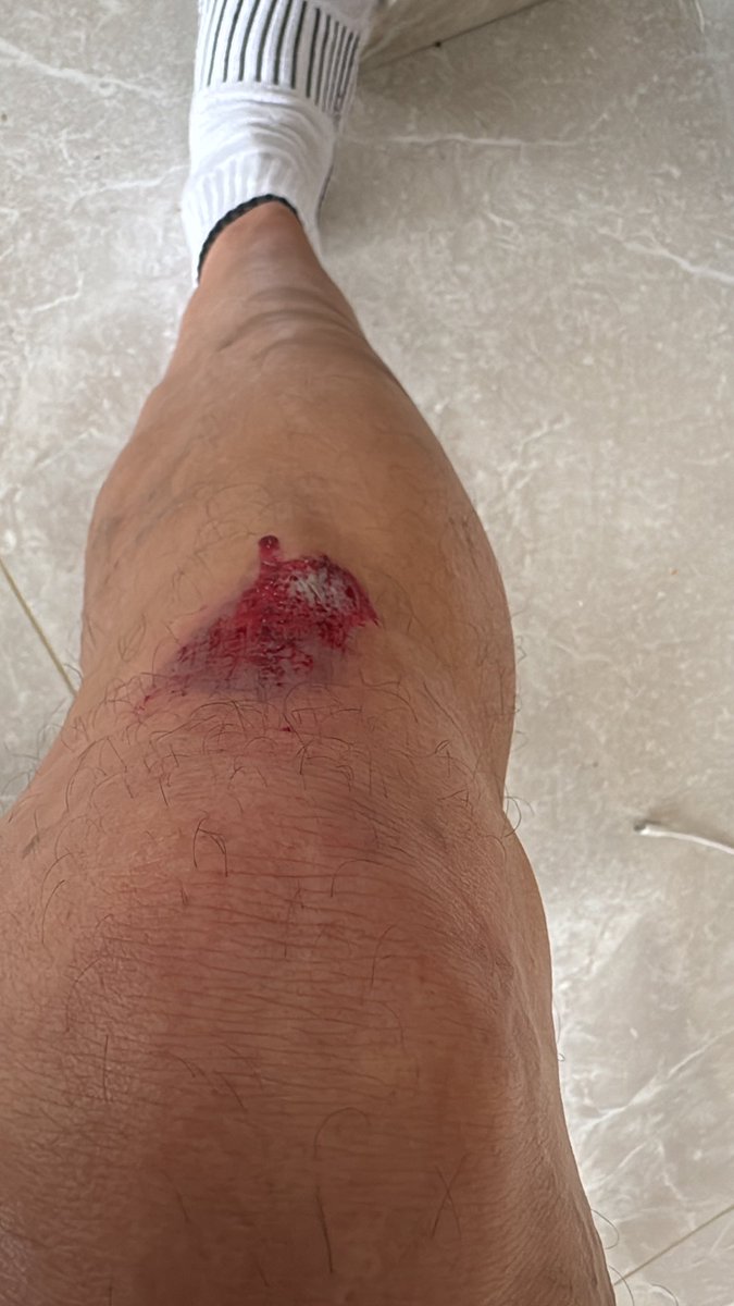 Phillip Nagy tweet media