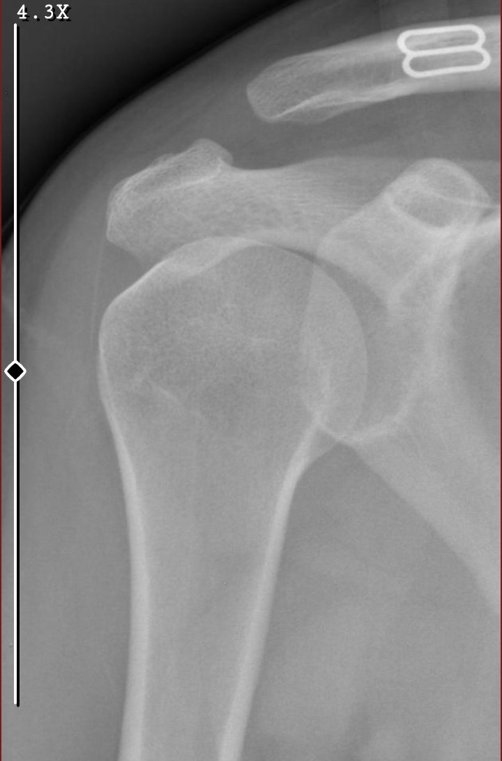 imposter tweet media