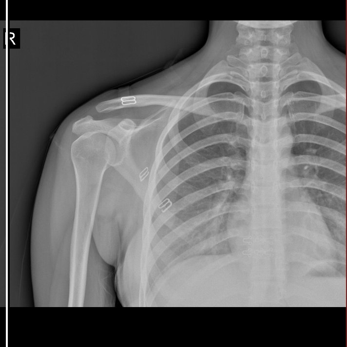 imposter tweet media