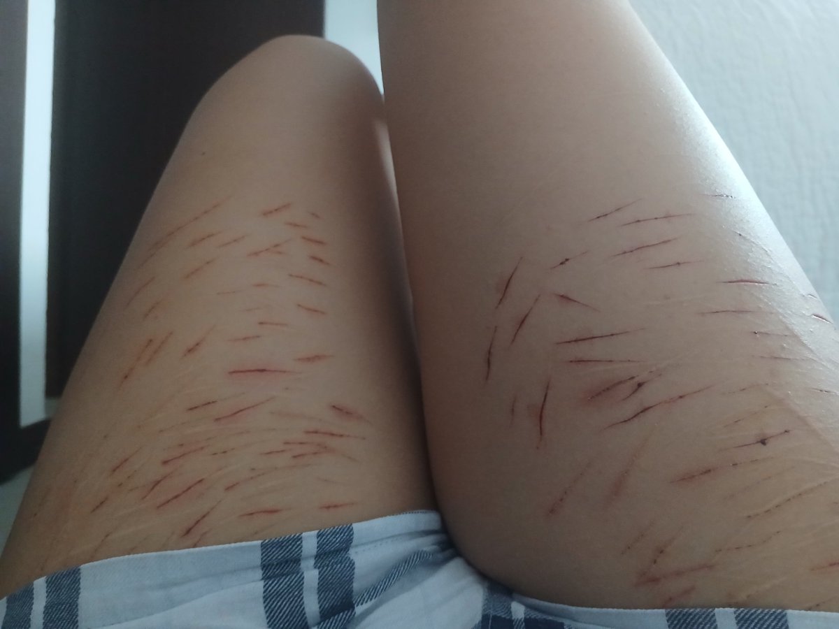 𝘿𝙤𝙧𝙞 𝙡𝙤𝙠𝙤𝙨 #bpdtwt/#shtwt tweet media