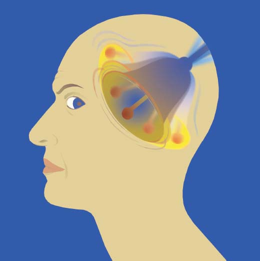 Brain & Life tweet media