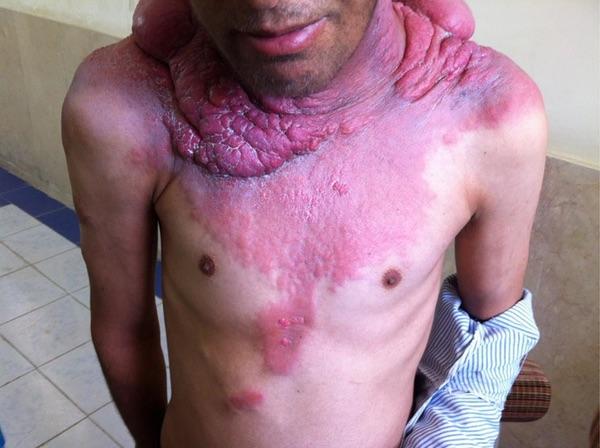 Dr Abdul Hameed 🩺 tweet media