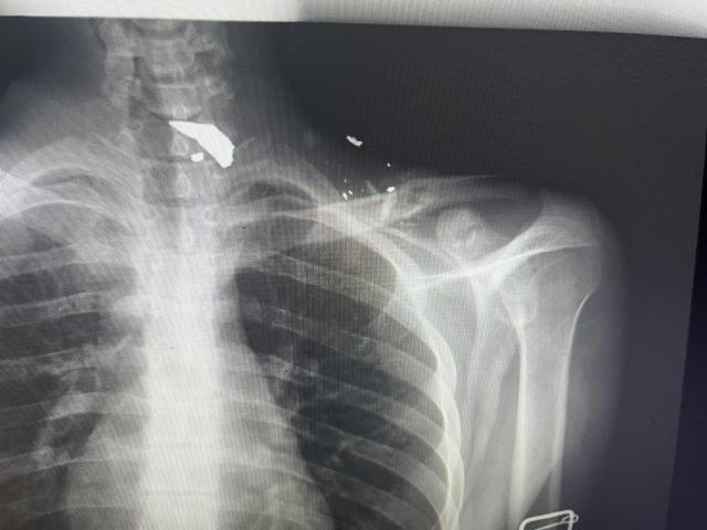 mohamd1997312's tweet photo. My husband, Muhammad, has suffered a severe neck and shoulder injury. Please help me.

I implore anyone with a conscience and courage not to abandon me. I am a free woman. Please.
https://t.co/ISragVMxH1
@adictoapple
@AKUTAG4W4 
@_saeedlutfi_ 
@aVOlDable 
@aVOlDable https://t.co/ppo5TO0Act
