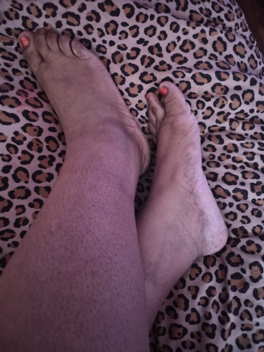 luvrgal444's tweet photo. Looking for serious buyers in this community! I'm an amateur but I know you love it. 💕😚

#feet #feetworshi̇p #feetfetısh #footfetısh #ebonyfeet #teenpyt https://t.co/rqIbJh5xta