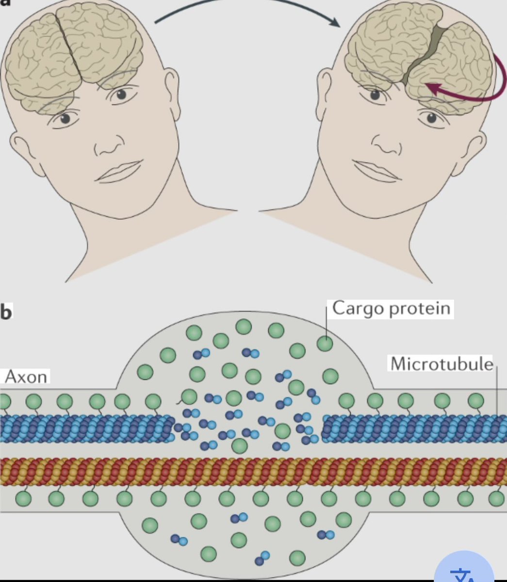 SterlingCooley's tweet image. This is probably what doomscrolling does to your brain btw