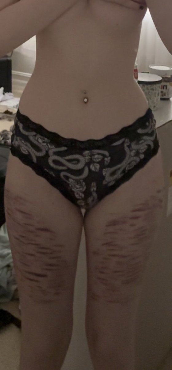 bblade_666's tweet image. am I thinspo yet?? I still feel like I’m huge #shedtwt #edtwt #thinspo