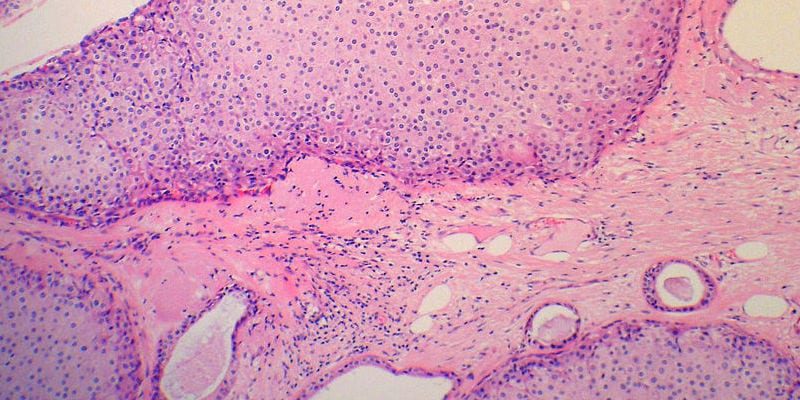 2 Minute Medicine® tweet media