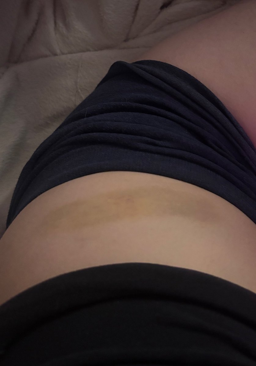 Romy 🌺 tweet media