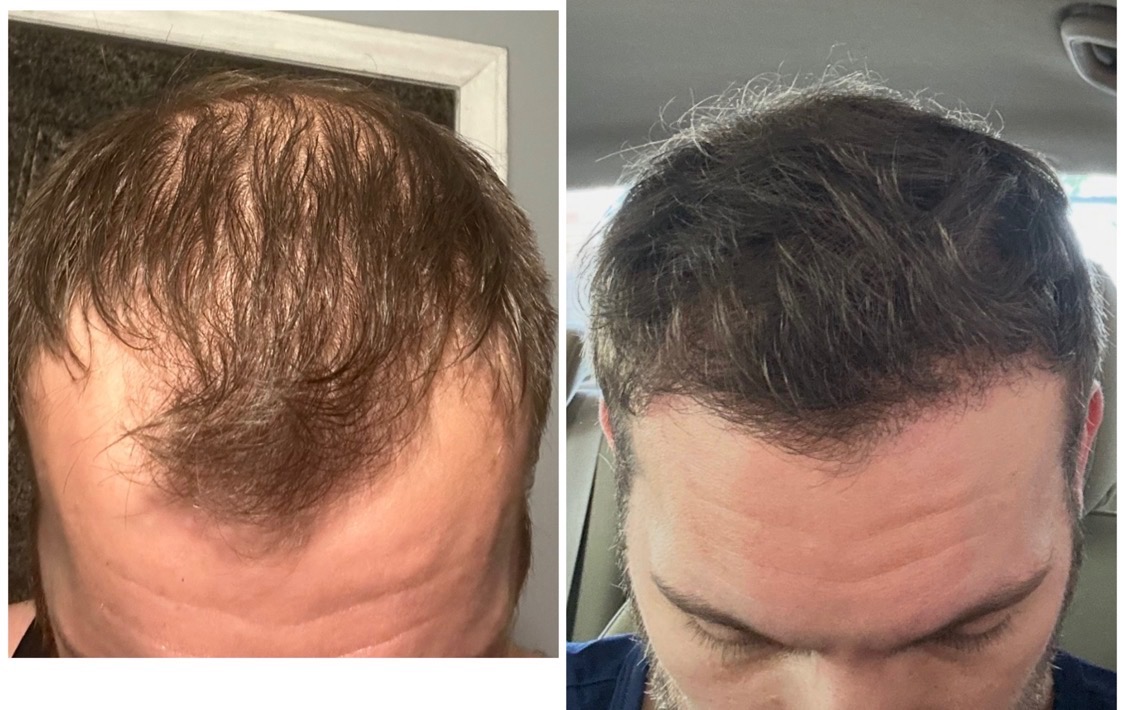 stock goat tweet media