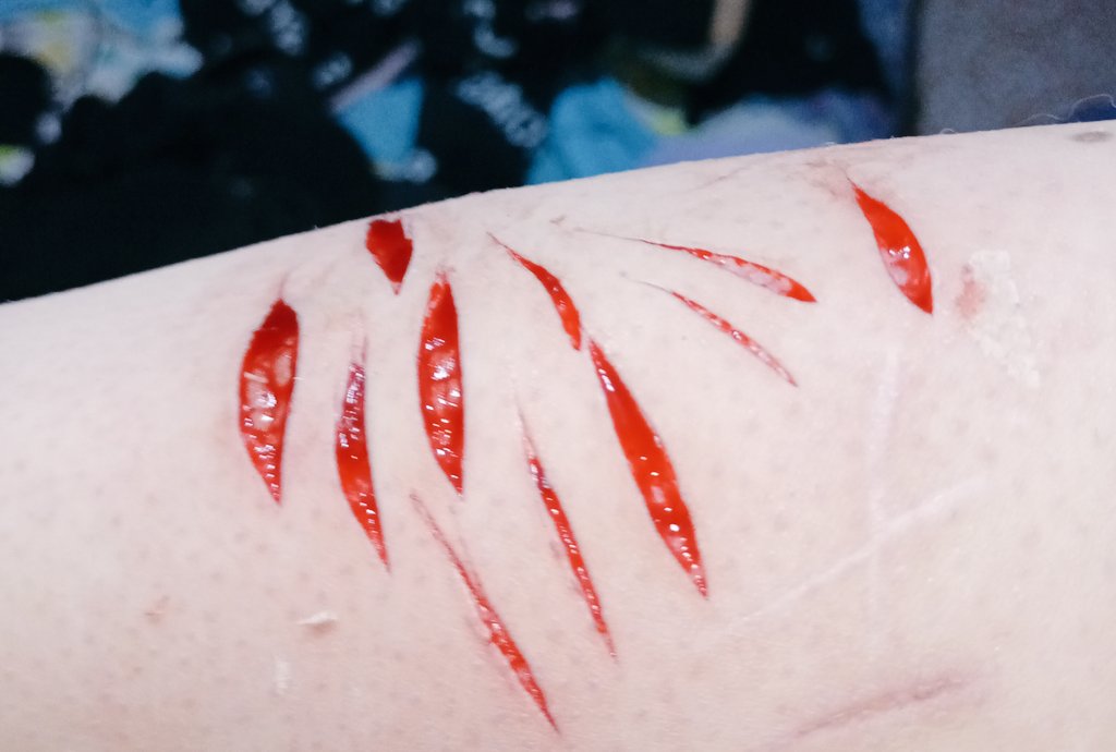 Eri10245's tweet photo. Tengo el brazo tan hinchado, me veo tan gordo. Doy asquito. Eww https://t.co/U509ZOGgEG