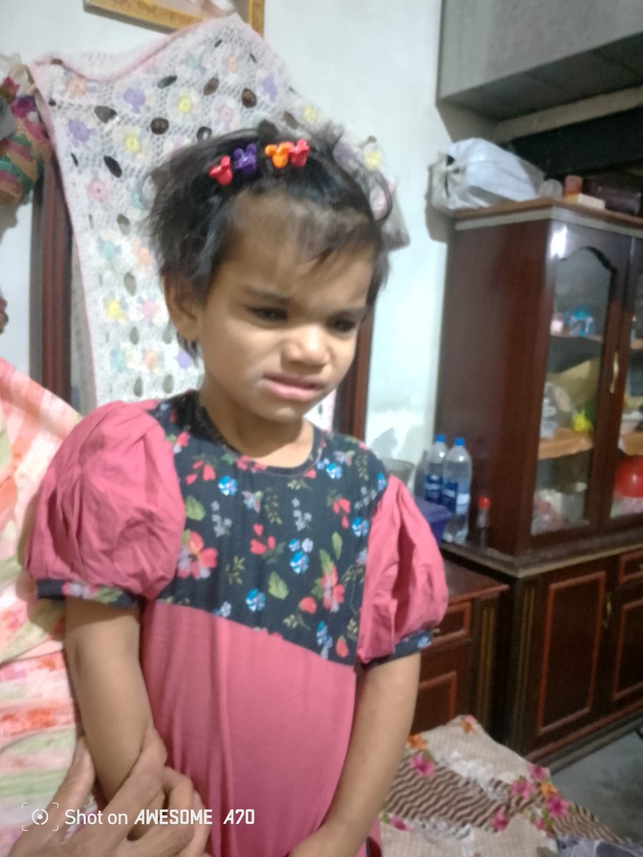 سرگودھا کی ان 3 سالہ دونوں بچیوں کو ہرنیاں ھیں ۔ اور انکا آپریشن ہونا ھے ۔ والدین نہایت غریب ہیں ۔ وزیراعلیٰ پنجاب <a href="/MaryamNSharif/">Maryam Nawaz Sharif</a>
 سپر ٹیم <a href="/CMComplaintCell/">Chief Minister’s Complaint Cell</a> اور ہیلتھ حکام <a href="/Kh_ImranNazir/">Khawaja Imran Nazeer</a> سے گزارش ھے کہ ان بچیوں کے آپریشن میں مدد کی جاٸے شکریہ
رابطہ نمبر متاثرین محمد اصغر
0303