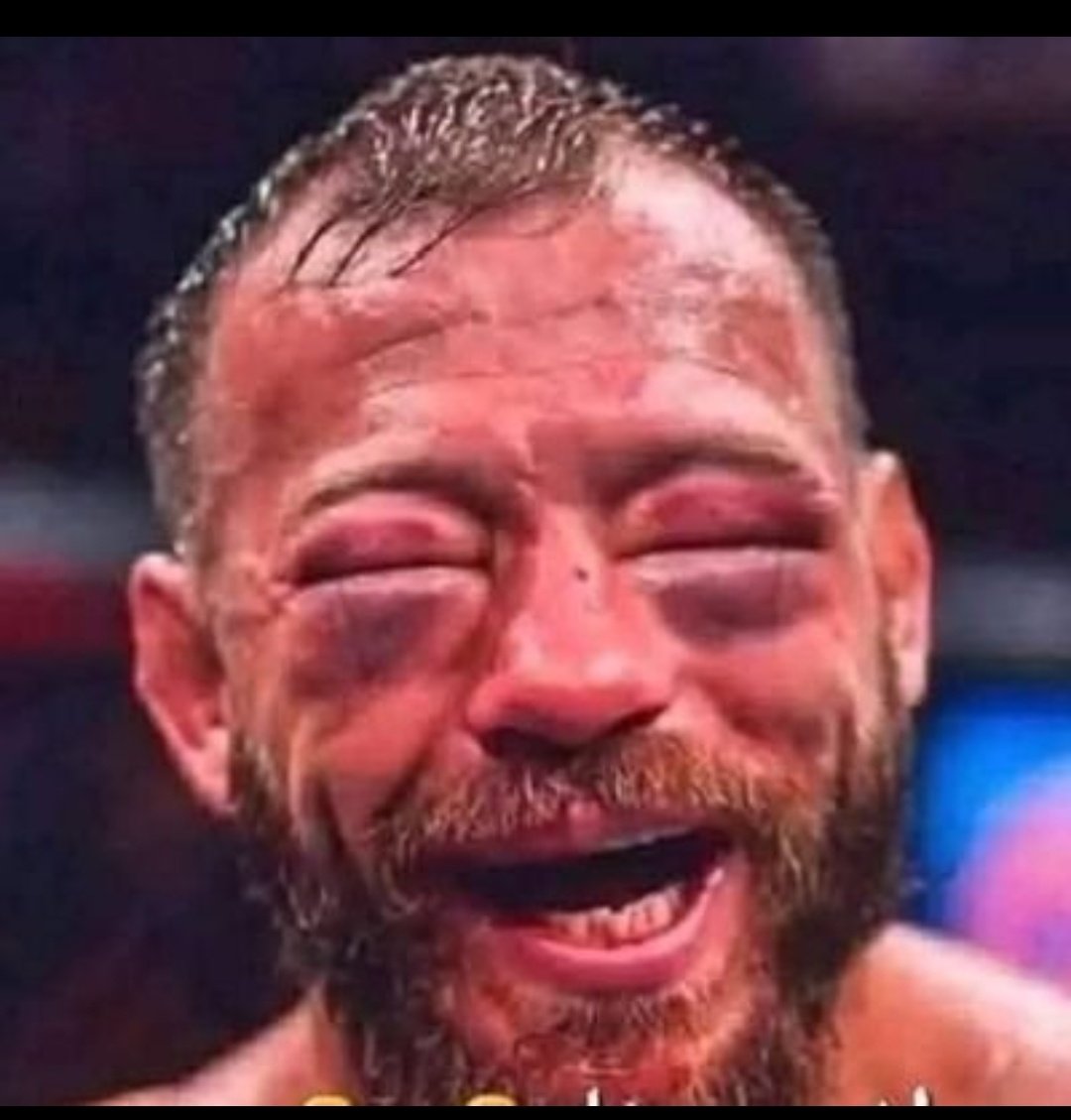 alamwi290's tweet photo. @MSAlmalik انتصرنا🤣🤣🤣
1.قتل جميع قيادات الصف الاول والثاني والثالث
من قادة الحرس الثوري والباسيج
2.قتل الخامنئي واغلب قيادات المعممين
3.تدمير جميع المطارات العسكرية والمدنية
4.تدمير جميع المصانع العسكرية والمستودعان
5.تدمير 90% من مستودعات واسلحة ايران
6.تدمير كل الثكنات العسكرية
يتبع https://t.co/ZcK9pdEdMg