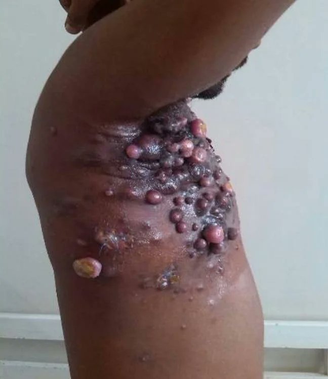 Dr Motasem Al-Gradey tweet media