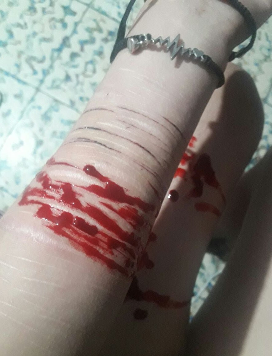 Sayl_mind's tweet photo. Mi brazo de 2024 era más lindo
"tenía menos cortes, obvio que si"
??? NO POR ESO en 2024 podía cortarme donde quería como se me daba la gana sin tener que tener un miedo constante en cortar sobre otros cortes cicatrizados y que se vean mal... https://t.co/EkysRtQDbu