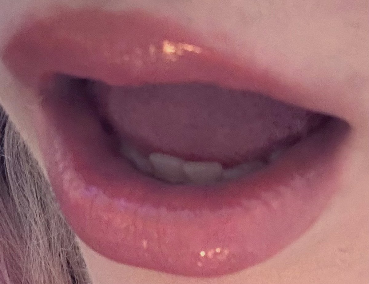 marin ₊˚⊹♡ tweet media