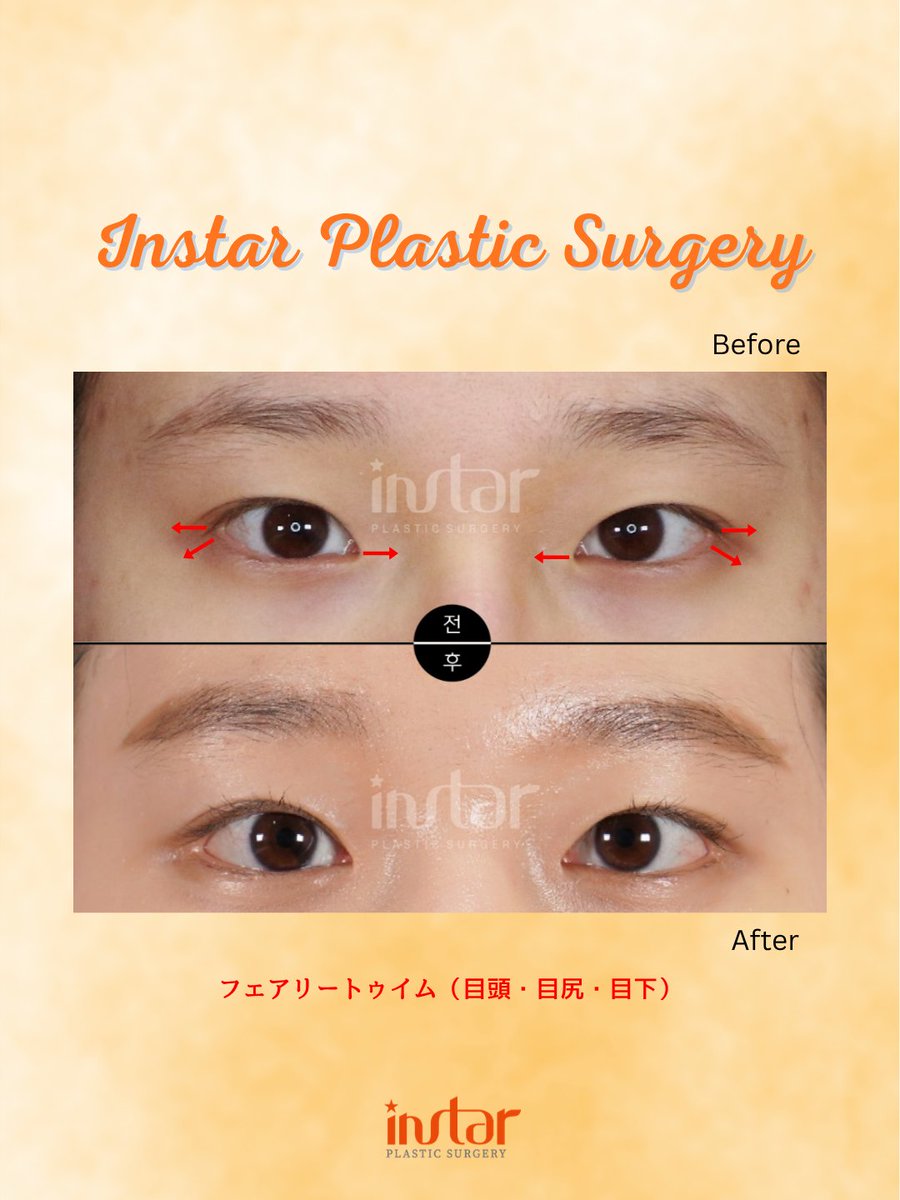 ⭐️instar整形外科⭐️ tweet media