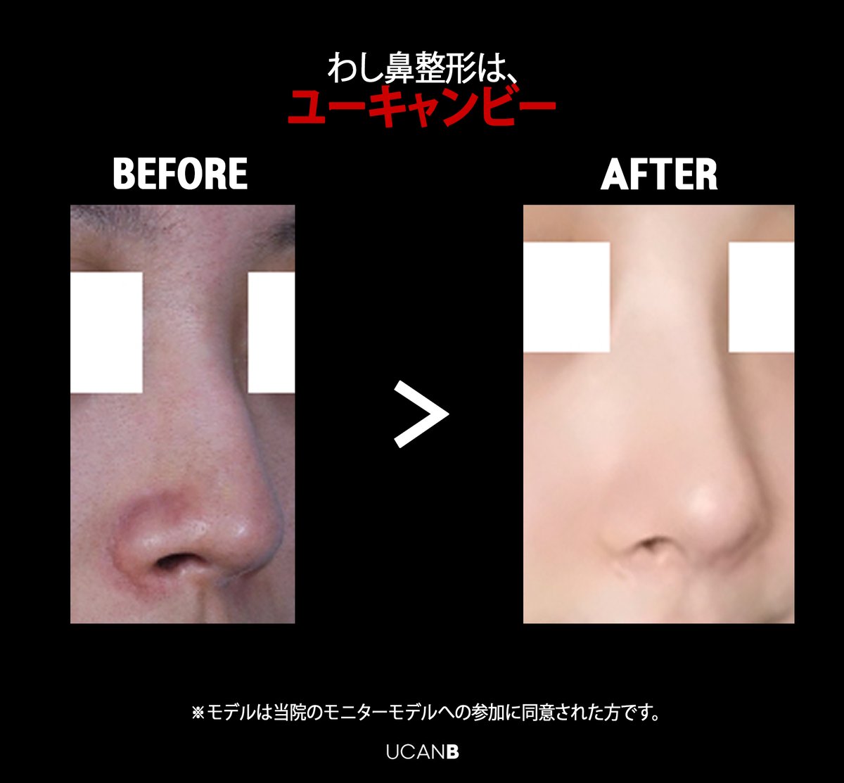 【公式】UcanB美容外科・皮膚科 tweet media