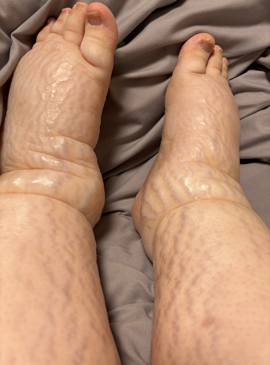 26歳のyu乳がんサバイバー tweet media