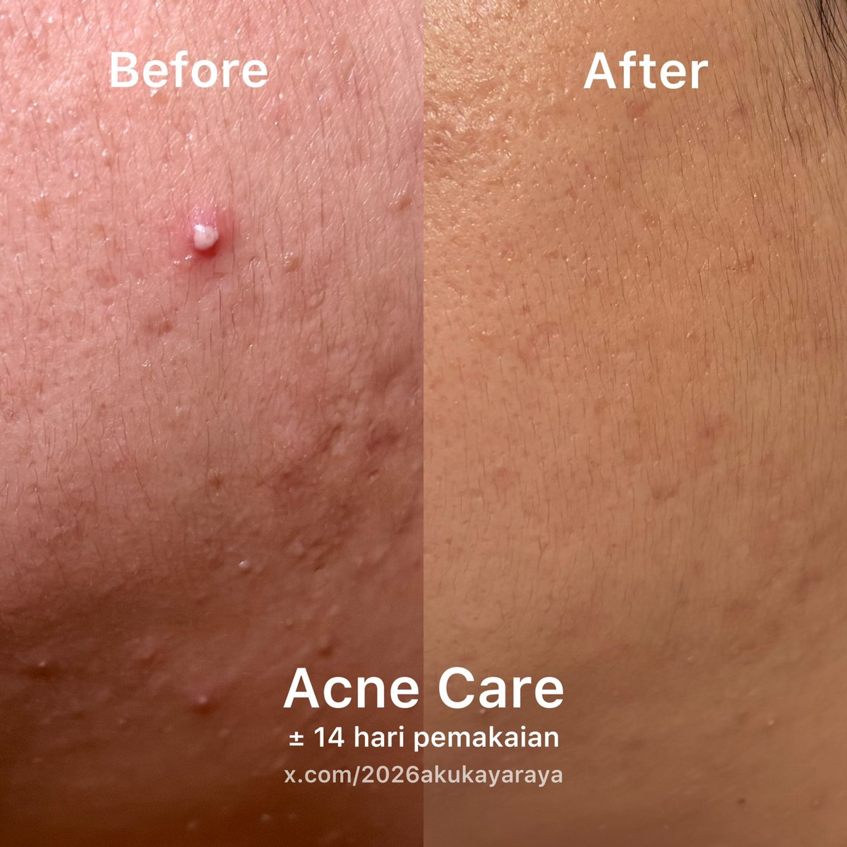 Bunga🌾 tweet media