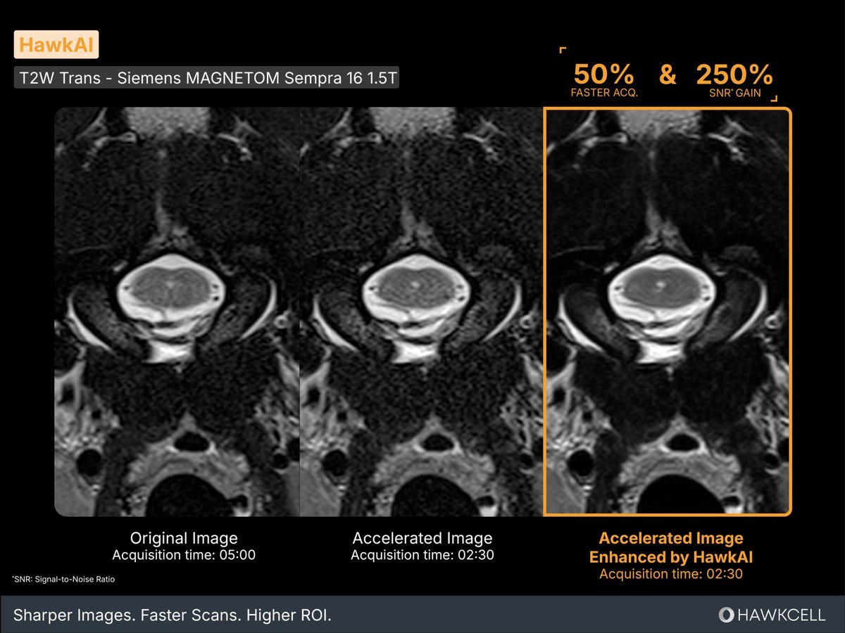 HawkCellVet's tweet photo. #HawkAI is redefining veterinary imaging performance.

Trained exclusively on animal data, it enables faster acquisitions, lower anesthesia time, higher SNR, better workflow control and optimized ROI.

👉🏻 Try it on your own images and see the difference: https://t.co/kgSTCHbryQ https://t.co/XCjUBY3eHh