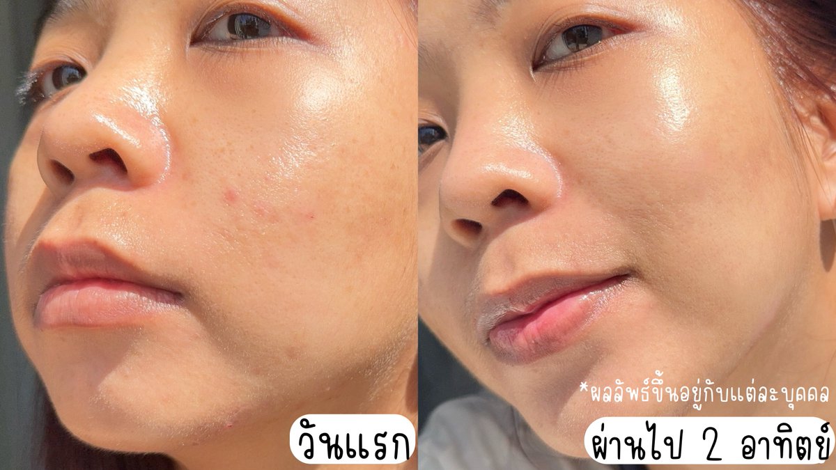 สหายบอญอ 🧸✨ tweet media